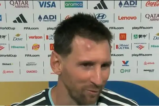 550x367_golpe-lionel-messi-termino-partido-ante-cabo-verde-visible-inflamacion-frente-despues-fuerte-choque-sobre-final-tiempo-reglamentario-1144060-140808